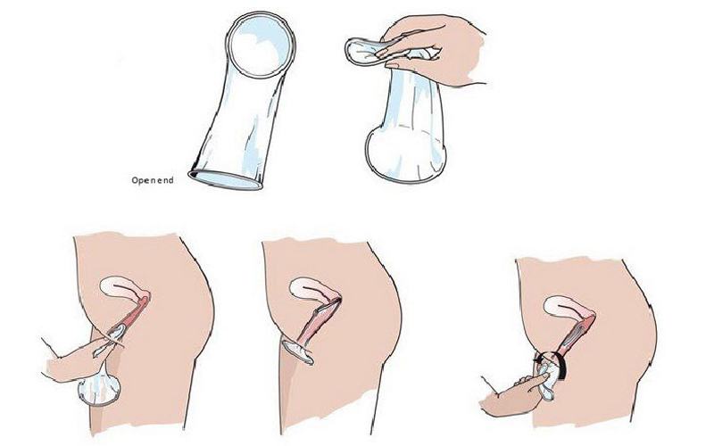 bạn cần phải kích thích âm đạo để tiết ra một ít dịch bôi trơn để việc đeo bao dễ dàng hơn