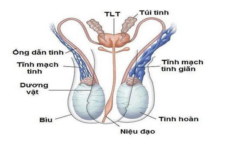 giãn tĩnh mạch thừng tinh