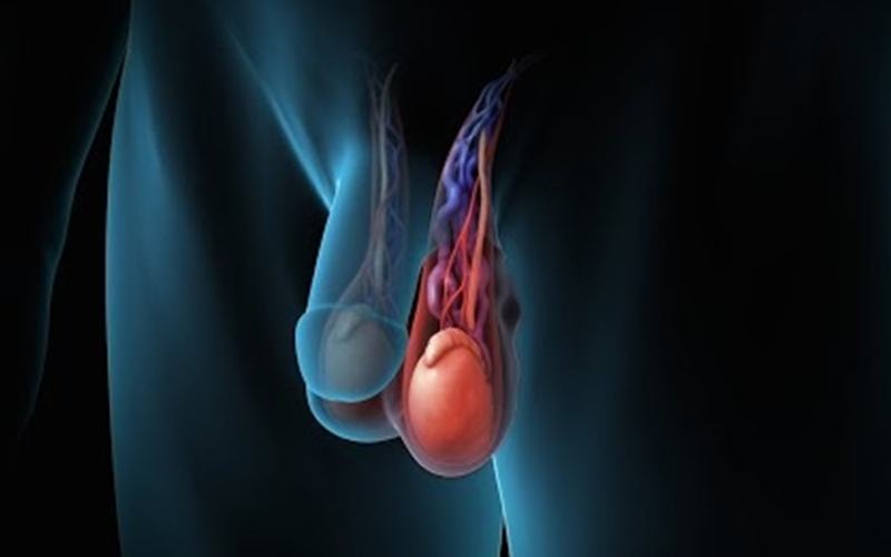 giãn tĩnh mạch thừng tinh