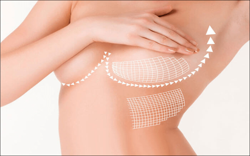 Trong quá trình massage, nên thoa dầu dừa, vitamin E hoặc mật ong lên ngực để tăng tác dụng