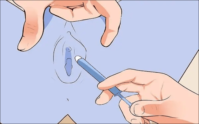 cần sử dụng băng vệ sinh khi cất thuốc vào âm đạo trong ngày