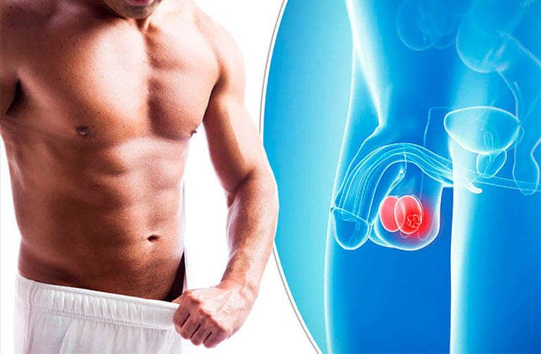 Cách chữa tinh hoàn bên to bên nhỏ