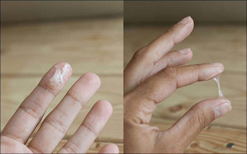 Ra huyết trắng sau quan hệ là biểu hiện của bệnh gì?